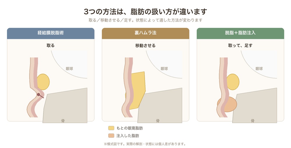 3つの方法の違い