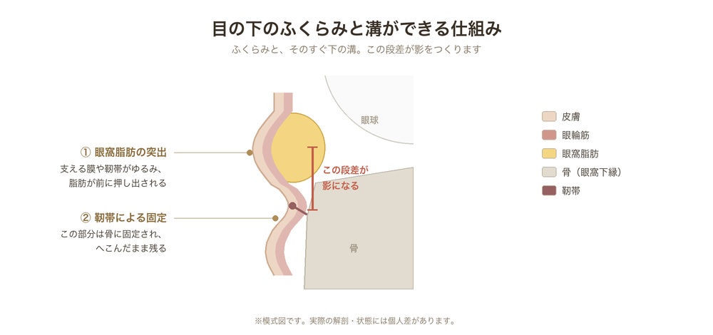 目の下のふくらみと溝ができる仕組み