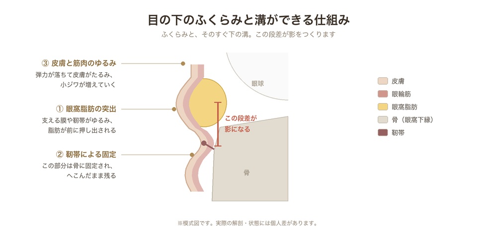 目の下のたるみを構成する3つの要素