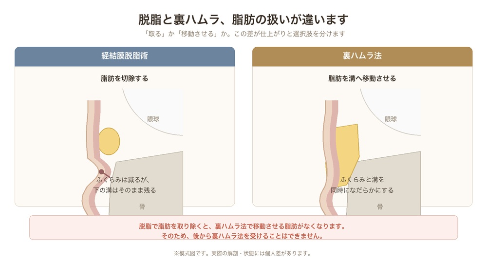 経結膜脱脂術と裏ハムラ法の違い