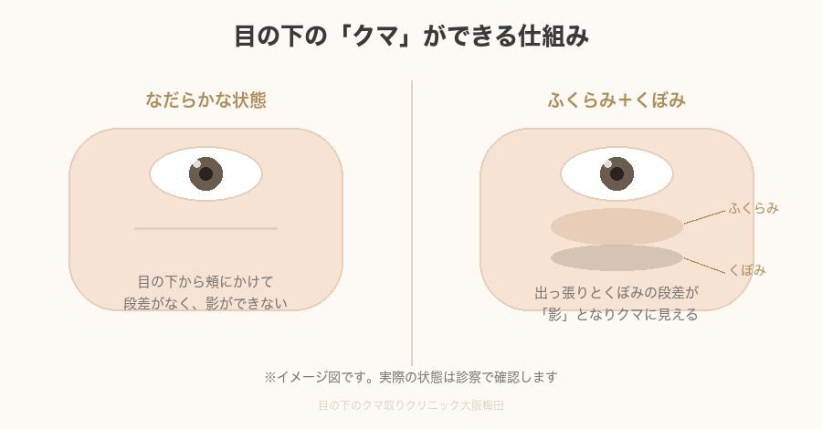 目の下のクマができる仕組み