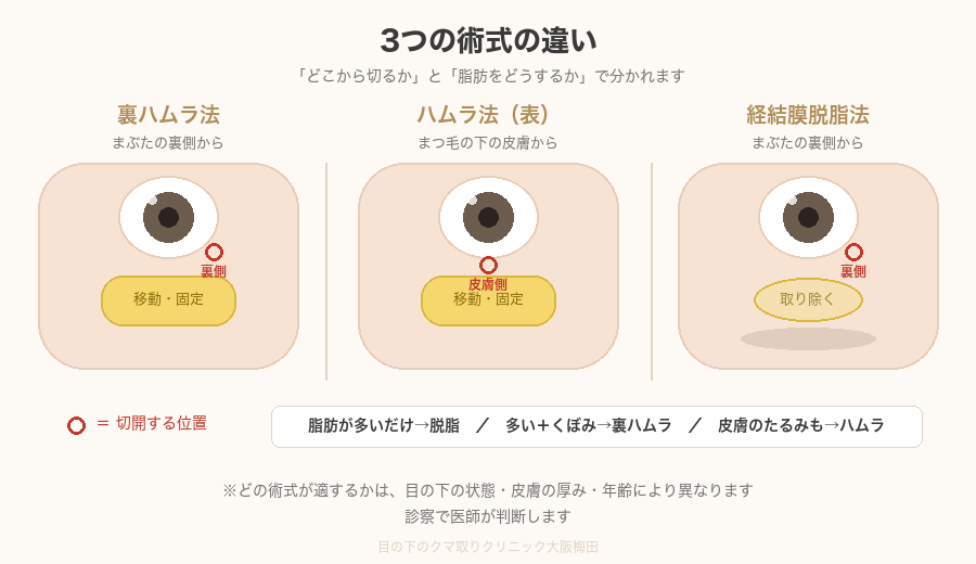3つの術式の比較